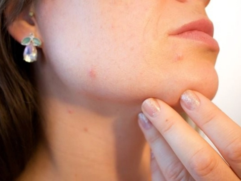 7 erstaunliche Natron-Vorteile für Haar, Haut und Körper