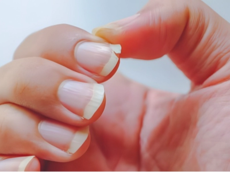 Ce que vos ongles révèlent sur votre bien-être